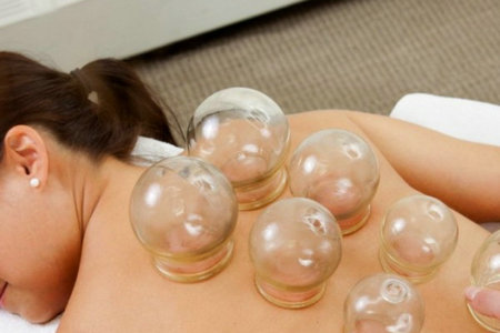 Cupping 10 Minutes
